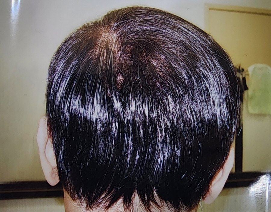 1948697120_Qscl12eZ_84ee28ca61a0358ade2f89a87593e9b30eb1a334.jpg 이미지크게보기