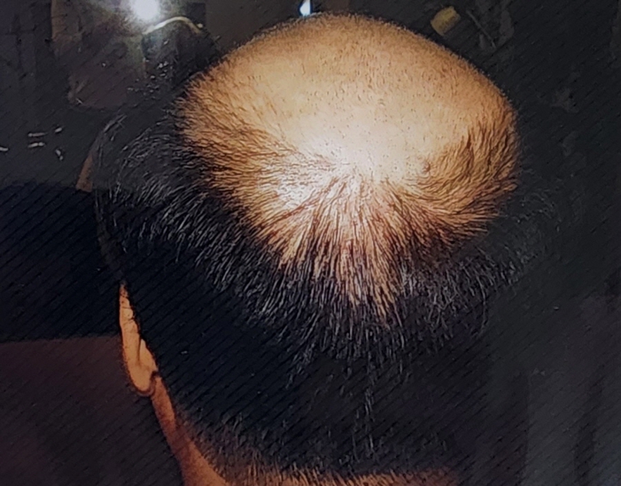 1948697120_UvRZhocs_dbb4782d9a245d9bf3e6f7683ce85b7c09db9706.jpg 이미지크게보기