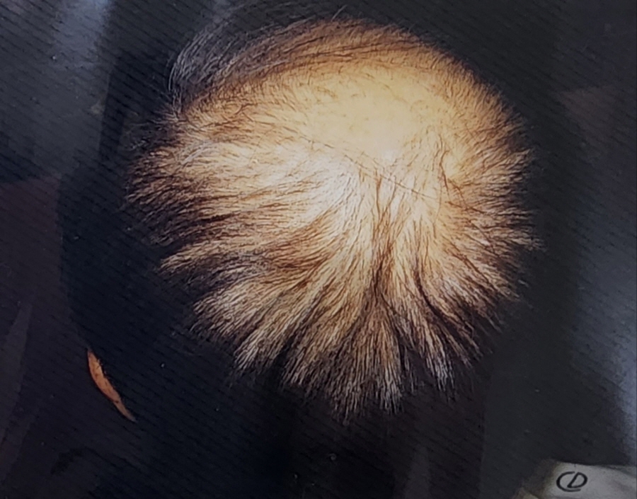 1948697120_XF8GVdEi_194af93154774bc5fcb3efac73af79c1497e4b74.jpg 이미지크게보기