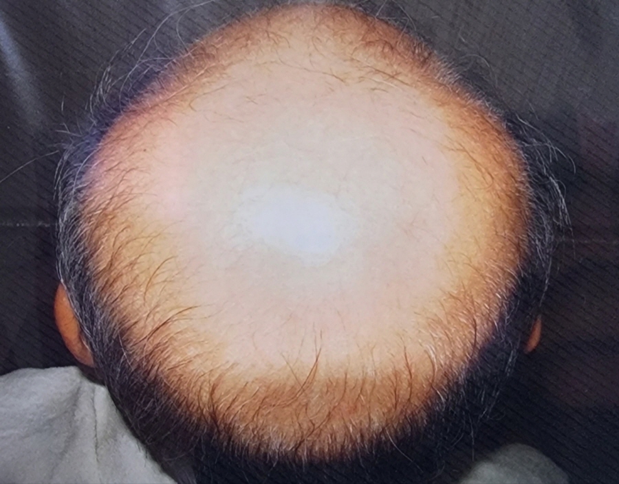 1948697120_bvOy9cB2_b9f53e20a7cd6ba171d18251a381dd2d89b89c43.jpg 이미지크게보기